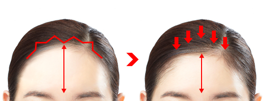 plastic surgery
